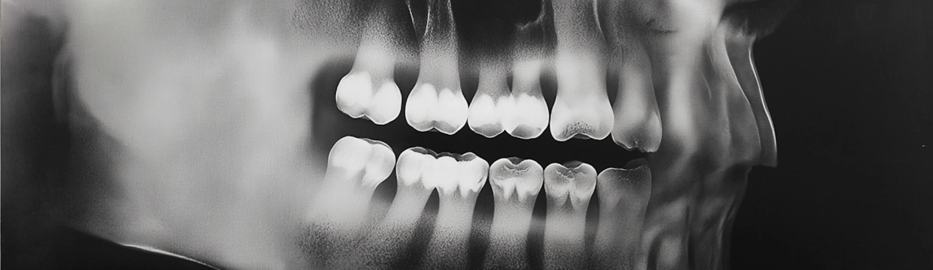 Dental Treatments: A Guide to Oral Health